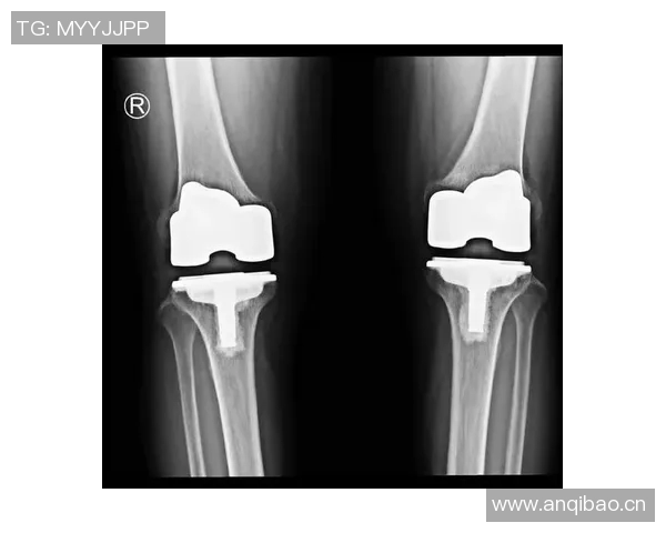 尤文图斯官方宣布卡巴尔右大腿肌肉受伤需两周后复查恢复情况